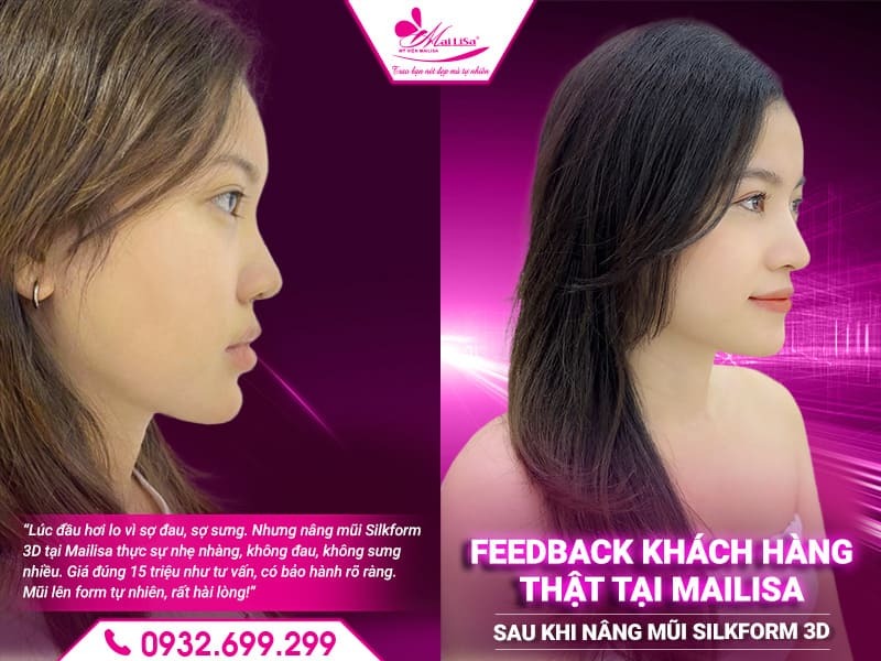 nang-mui-tai-mailisa-co-phat-sinh-gi-khong
