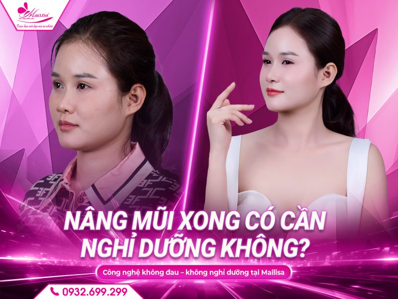 nang-mui-xong-co-can-nghi-duong-khong