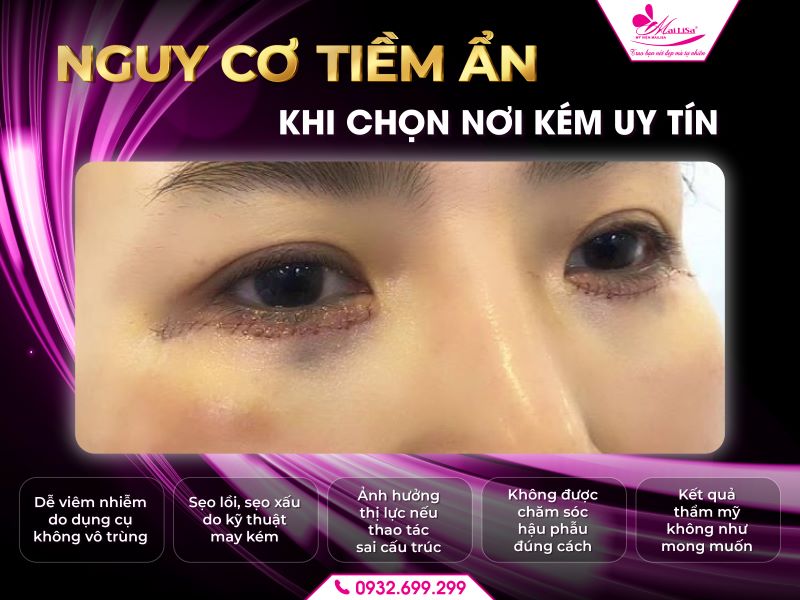nguy-co-tiem-an-khi-chon-noi-kem-uy-tin