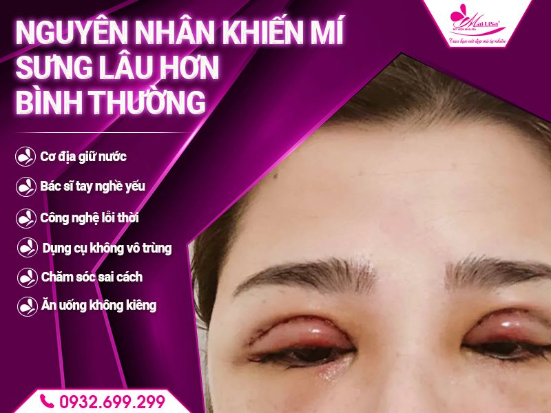 nguyen-nhan-khien-mi-sung-lau-hon-binh-thuong