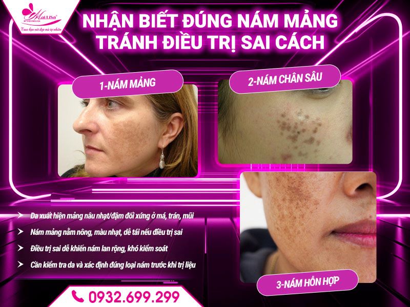 nhan-biet-dung-nam-mang-tranh-dieu-tri-sai-cach
