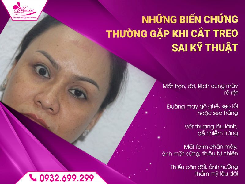nhung-bien-chung-thuong-gap