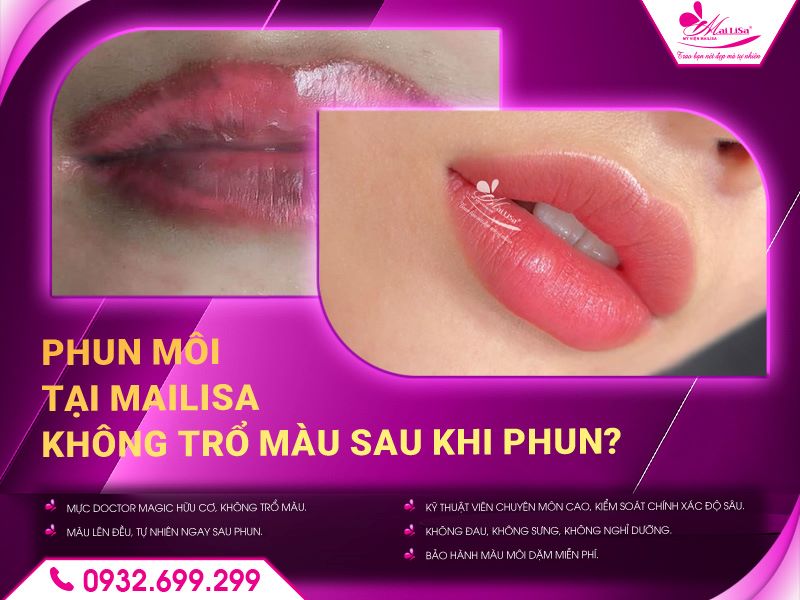 phun-moi-tai-mailisa