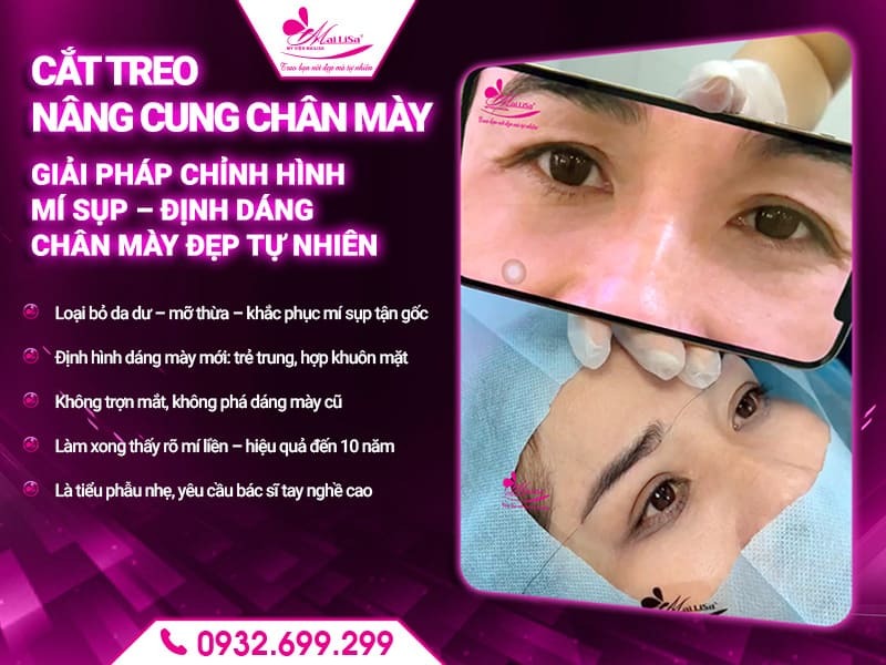 phuong-phap-nang-cung-chan-may-tot-nhat