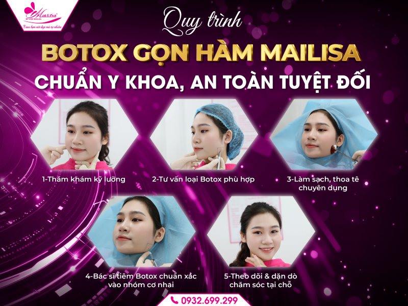 quy-trinh-botox-gon-ham-mailisa