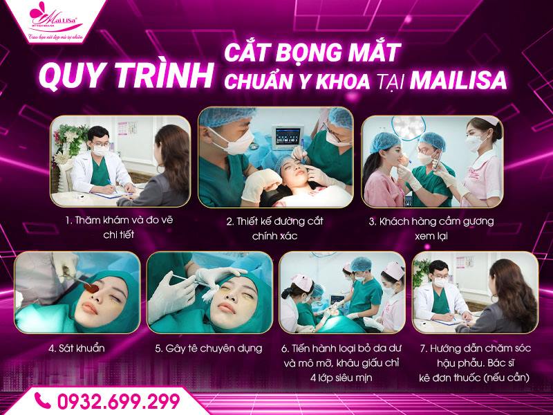 quy-trinh-cat-bong-mat-chuan-y-khoa-tai-mailisa