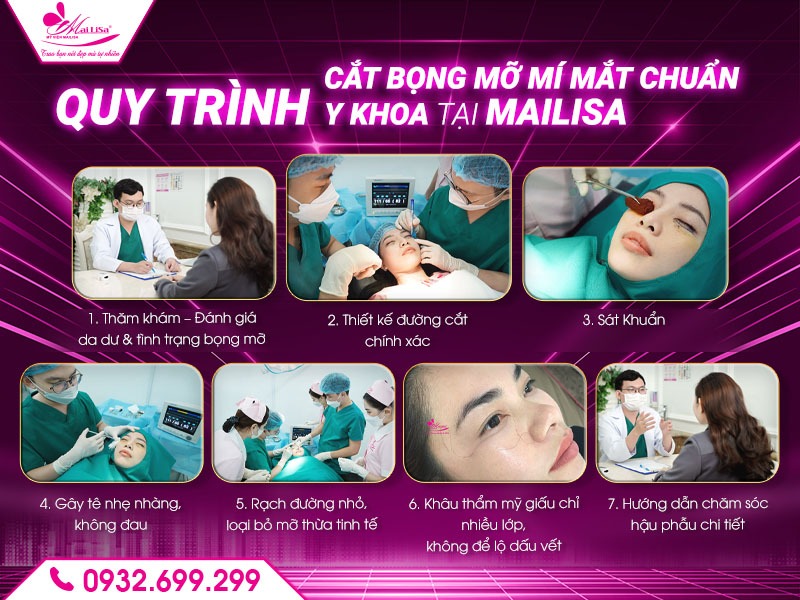 cat-bong-mat-o-dau-an-toan