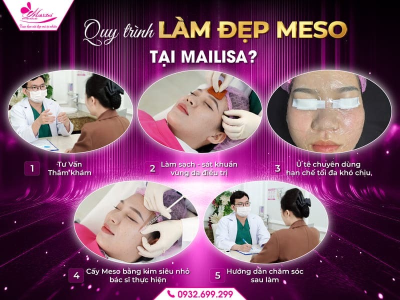 meso-an-toan-tai-mailisa