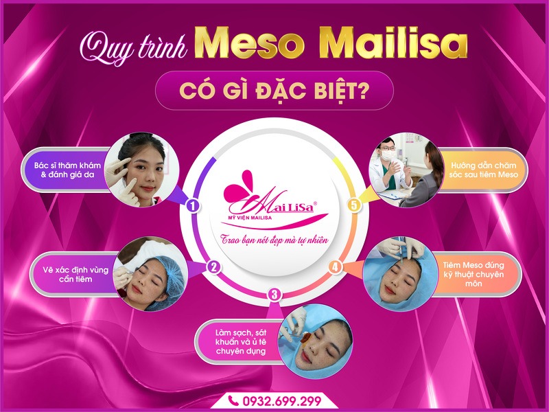 meso-giup-lam-day-seo-ro-mailisa