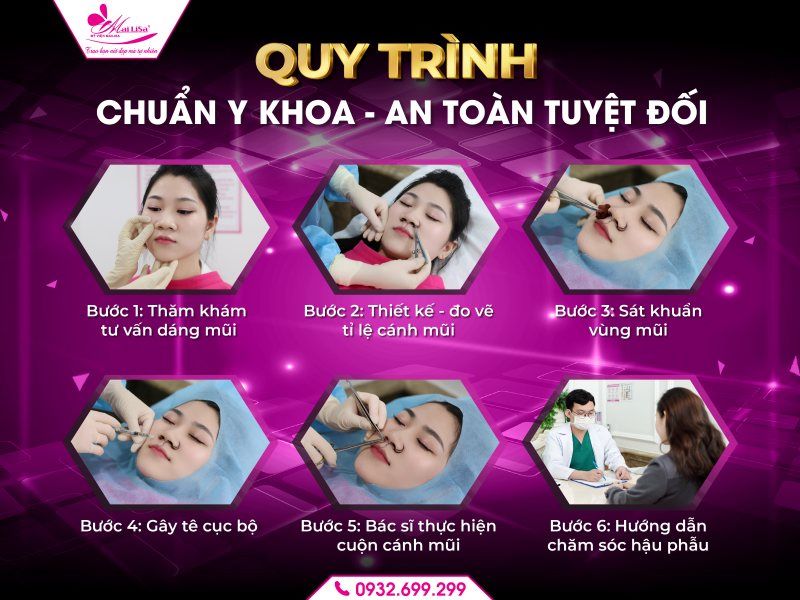 quy-trinh-chuan-y-khoa-an-toan-tuyet-doi