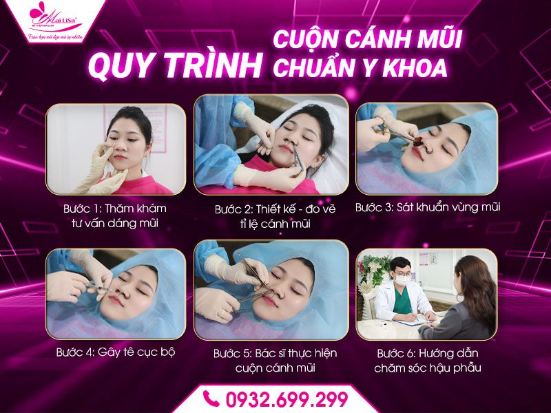 quy-trinh-cuon-canh-mui-chuan-y-khoa