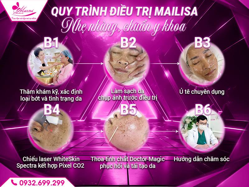 quy-trinh-dieu-tri-mailisa