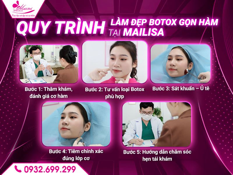quy-trinh-lam-dep-botox-gon-ham-tai-mailisa