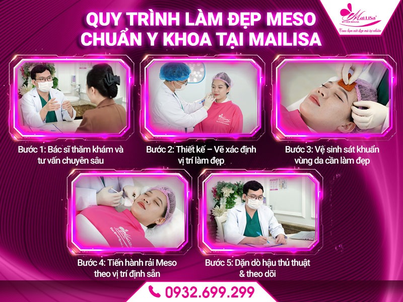 lam-dep-da-bang-meso-co-gay-kich-ung-khong