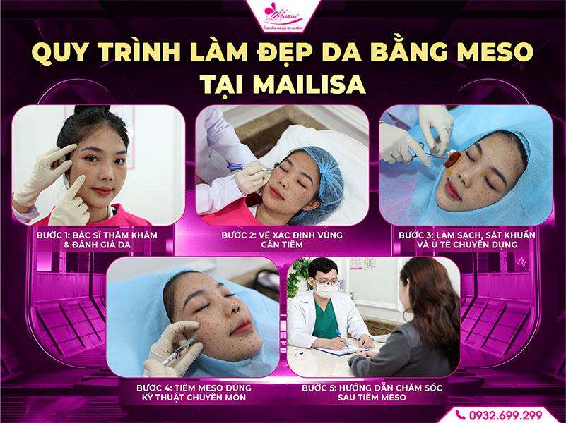 quy-trinh-lam-dep-da-bang-meso-tai-mailisa