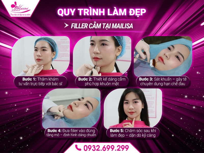 lam-dep-filler-cam-co-an-toan-khong