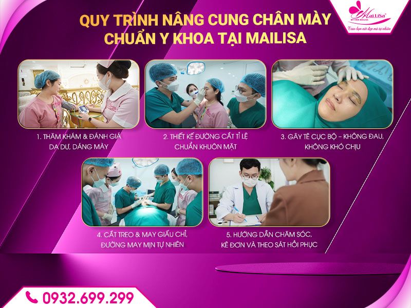 quy-trinh-nang-cung-chan-may-chuan-y-khoa-tai-mailisa