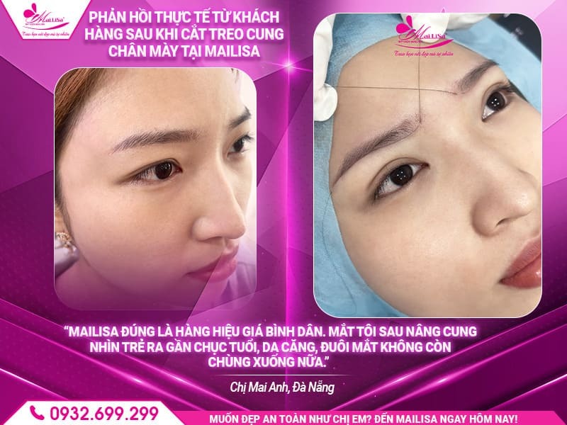 quy-trinh-nang-cung-chan-may-tai-mailisa