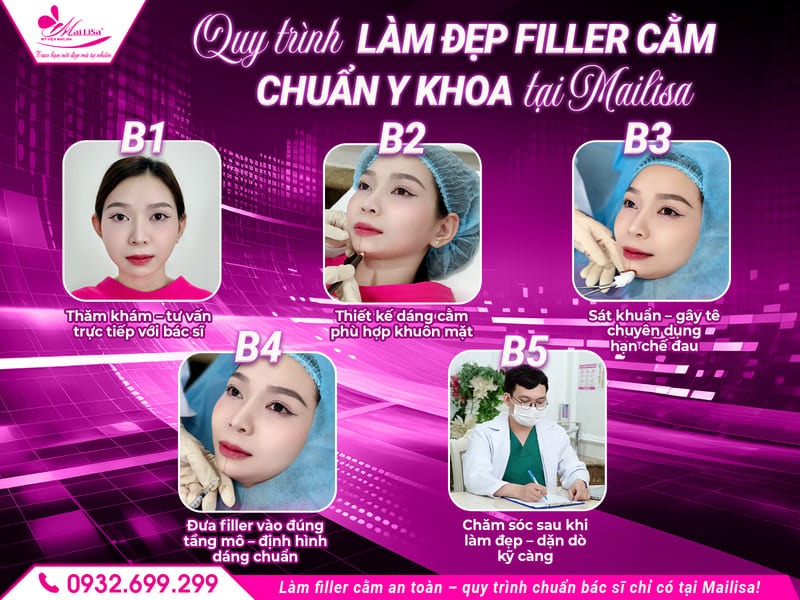 filler-cam-bao-lau-thi-dep