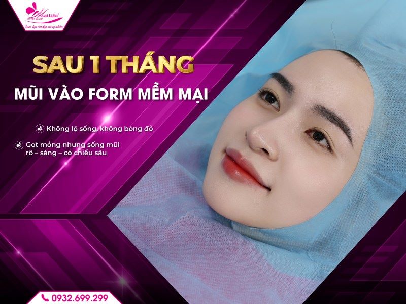 sau-1-thang-mui-vao-form-mem-mai