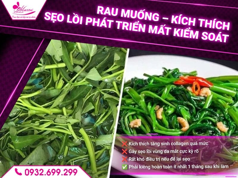 sau-khi-cat-bong-mat-nen-kieng-gi