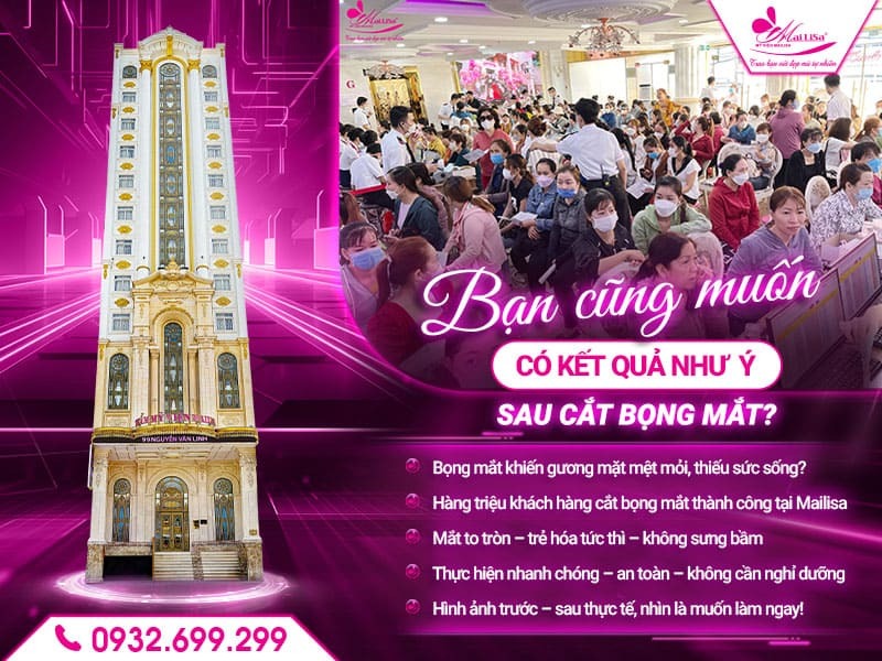 sau-khi-cat-bong-mat-nen-kieng-gi