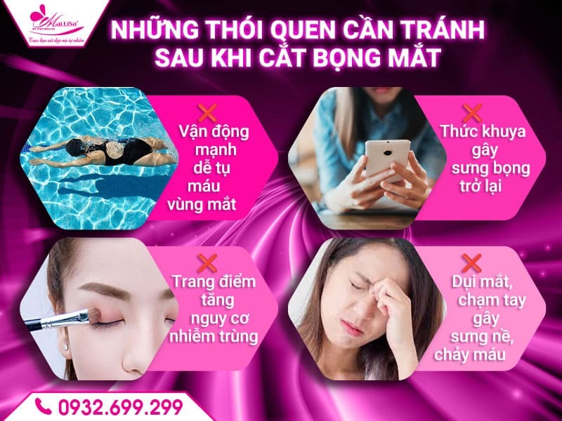 sau-khi-cat-bong-mat-nen-kieng-gi