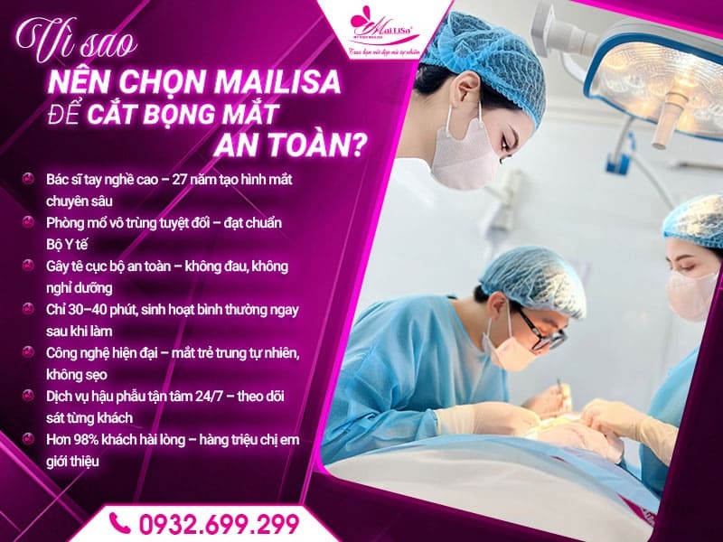 sau-khi-cat-bong-mat-nen-kieng-gi