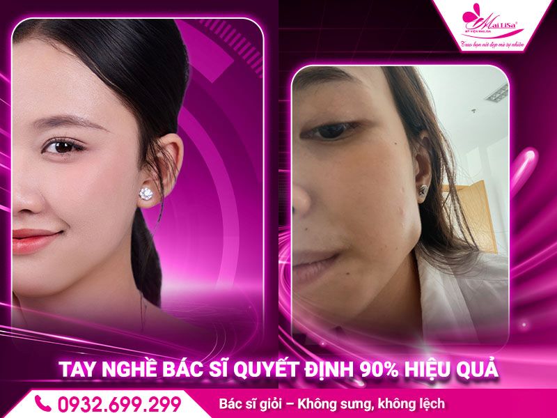 tay-nghe-bac-si-quyet-dinh-90-hieu-qua
