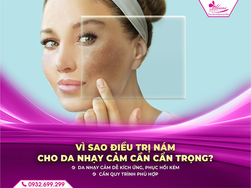 dieu-tri-nam-cho-da-nhay-cam