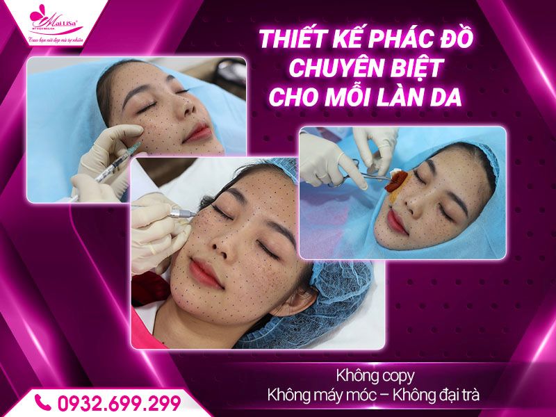 thiet-ke-phac-do-chuyen-biet-cho-moi-lan-da
