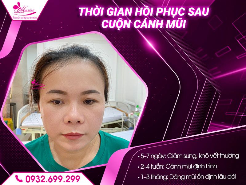 thoi-gian-hoi-phuc-sau-cuon-canh-mui