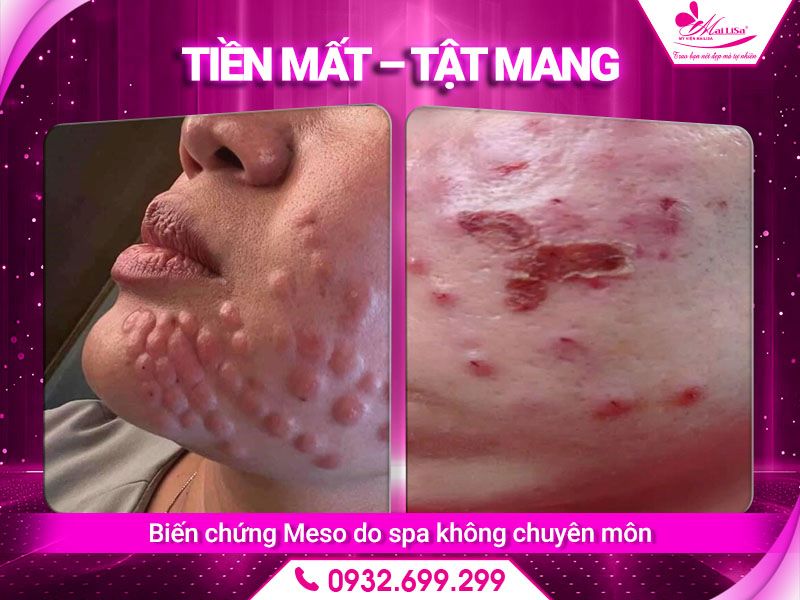 tien-mat-tat-mang
