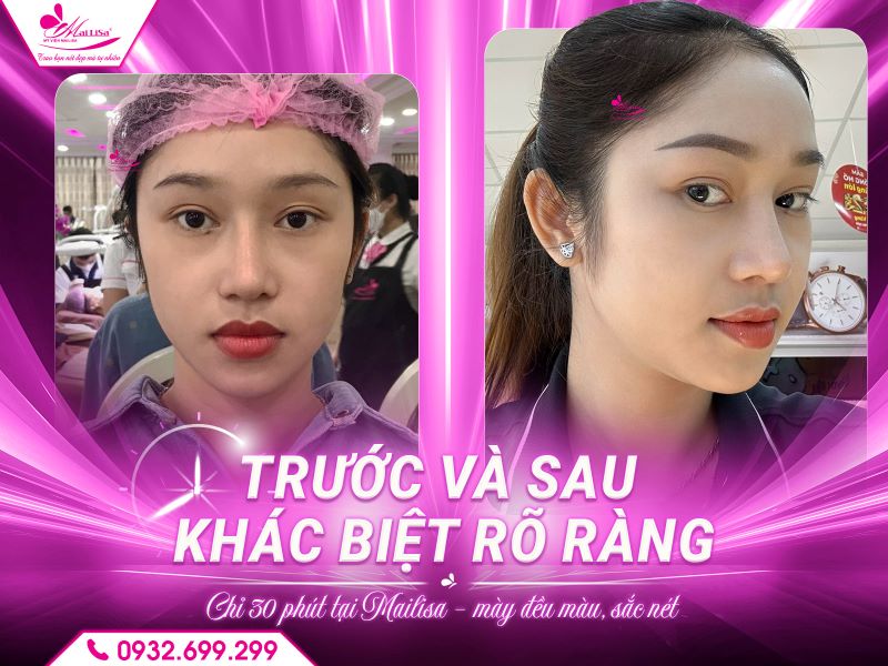 truoc-sau-khac-biet-ro-rang