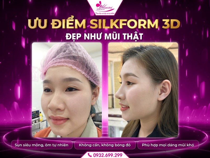 uu-diem-silkform-3d-dep-tu-nhien