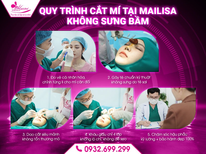 vi-sao-cat-mi-bi-sung