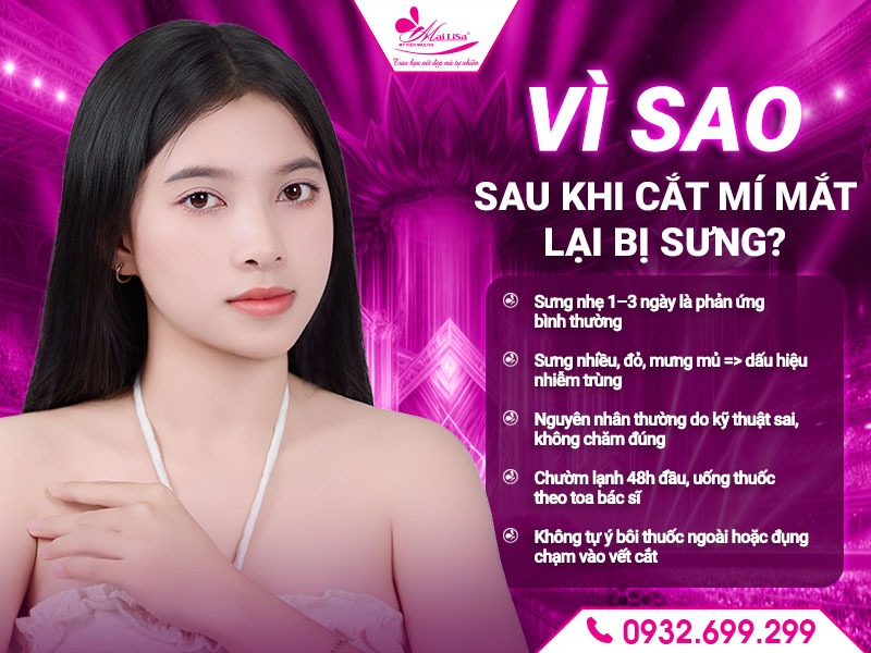 vi-sao-cat-mi-bi-sung
