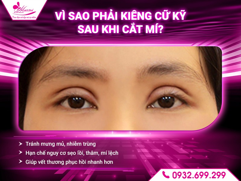 cat-mi-kieng-an-gi-de-tranh-bien-chung