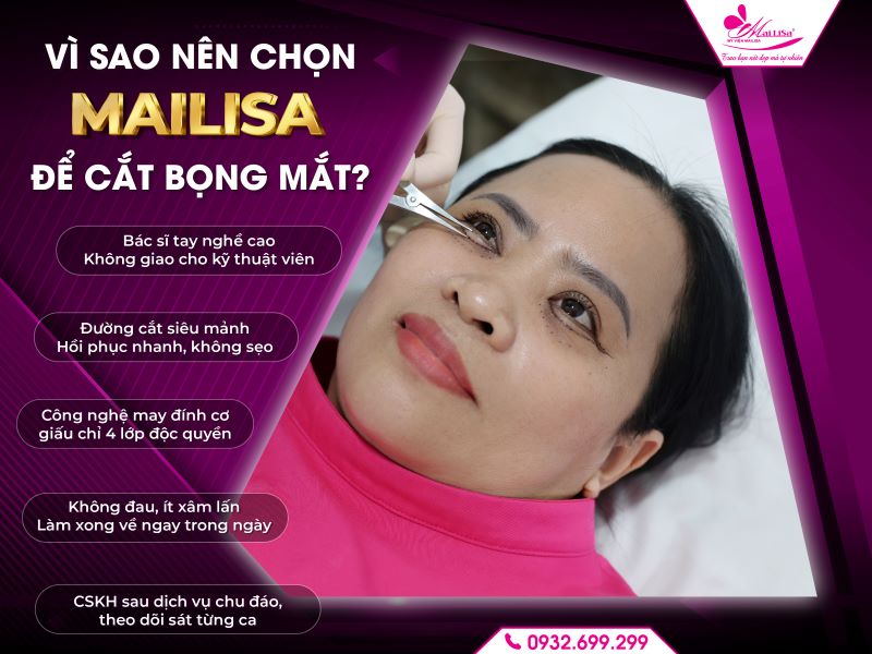 vi-sao-nen-chon-mailisa-de-cat-bong-mat