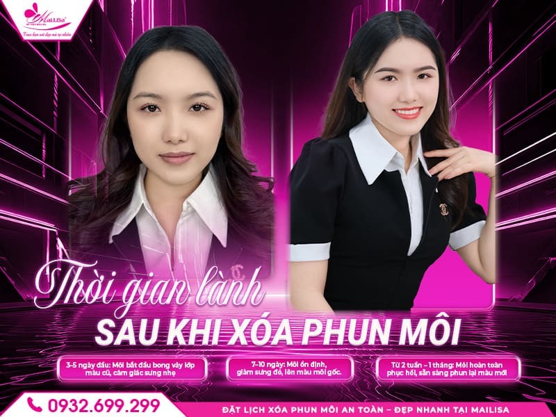 xoa-phun-moi-bao-lau-thi-lanh