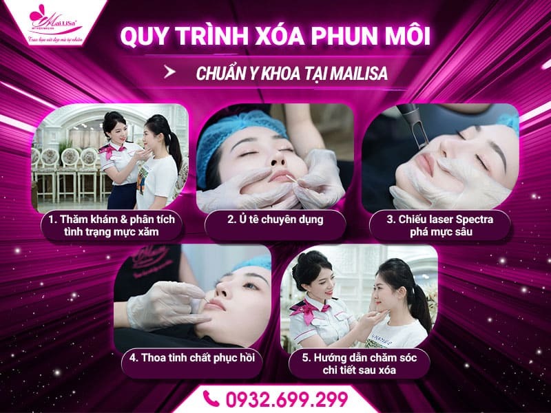 xoa-phun-moi-hieu-qua-nhat