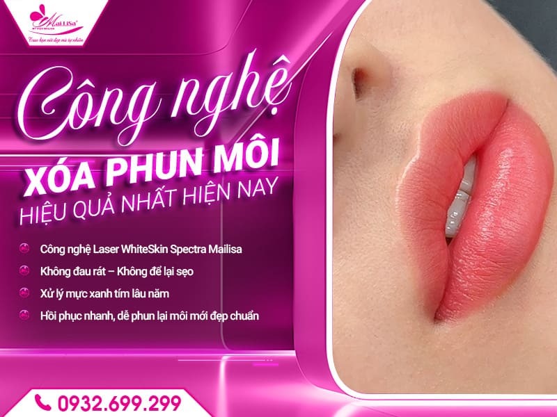xoa-phun-moi-hieu-qua-nhat