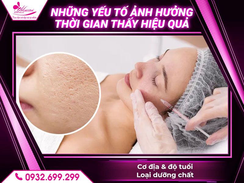 yeu-to-anh-huong