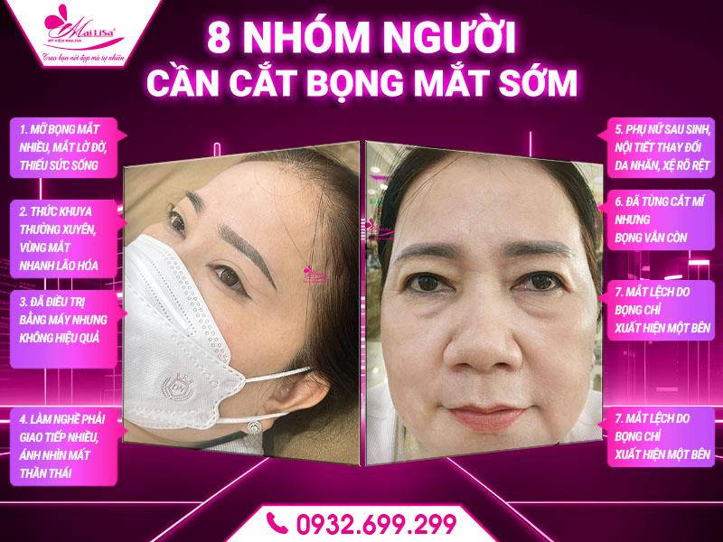 8-nhom-nguoi-can-cat-bong-mat-som