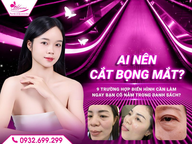 ai-nen-cat-bong-mat