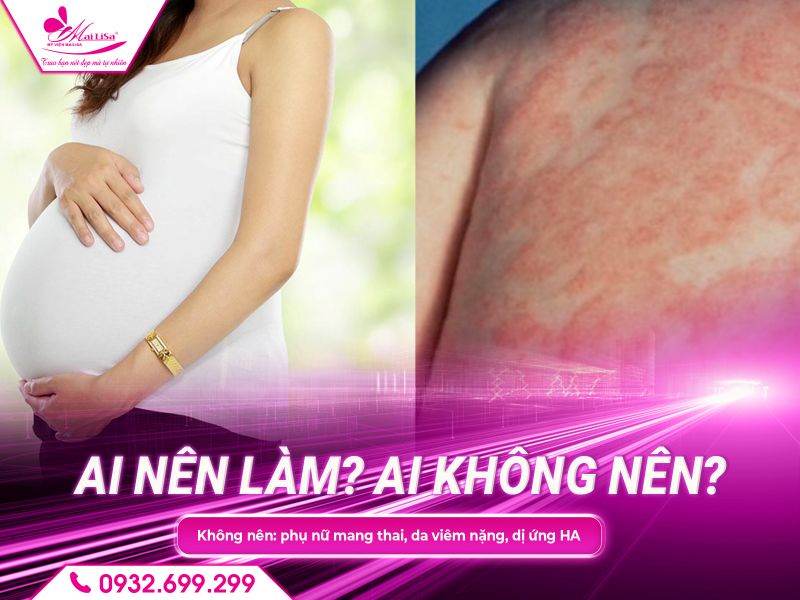 ai-nen-lam-ai-khong-nen