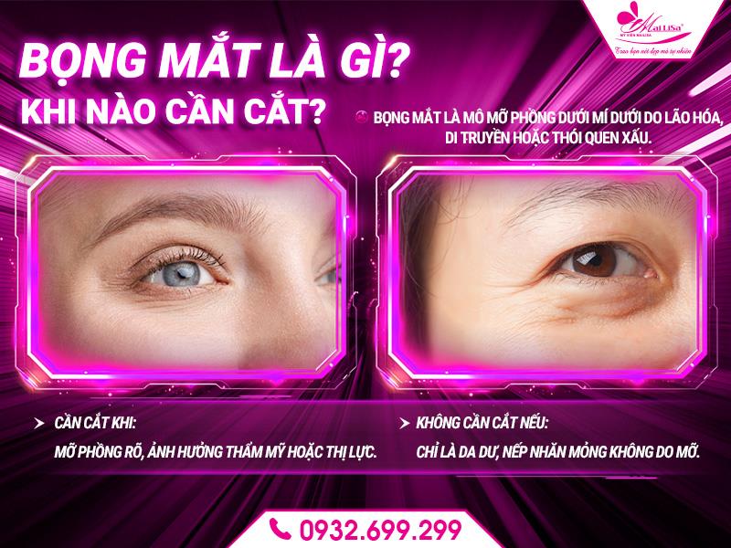 bong-mat-la-gi-khi-nao-can-cat
