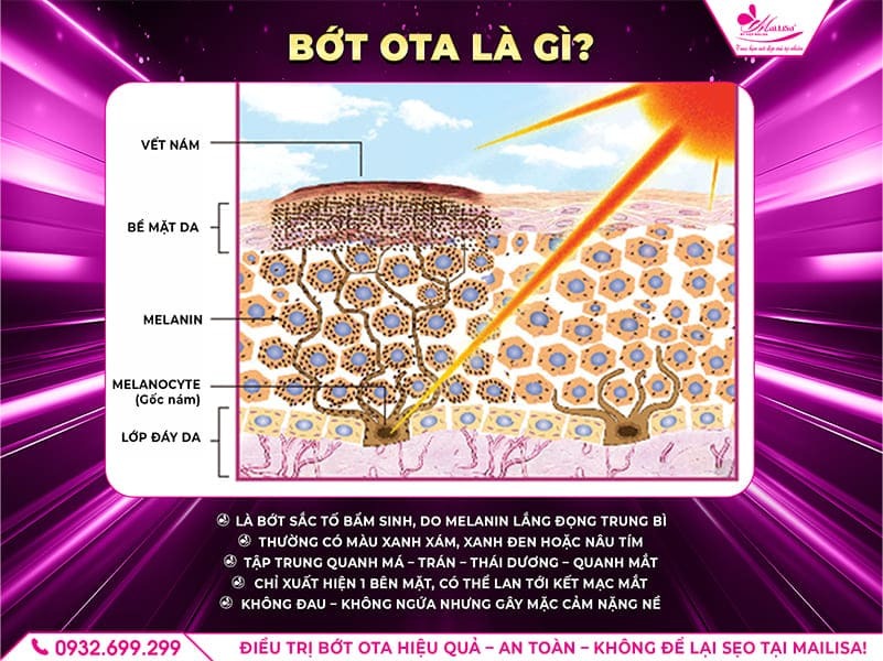 https://mailisa.com/wp-content/uploads/2025/09/bot-ota-la-gi.jpg