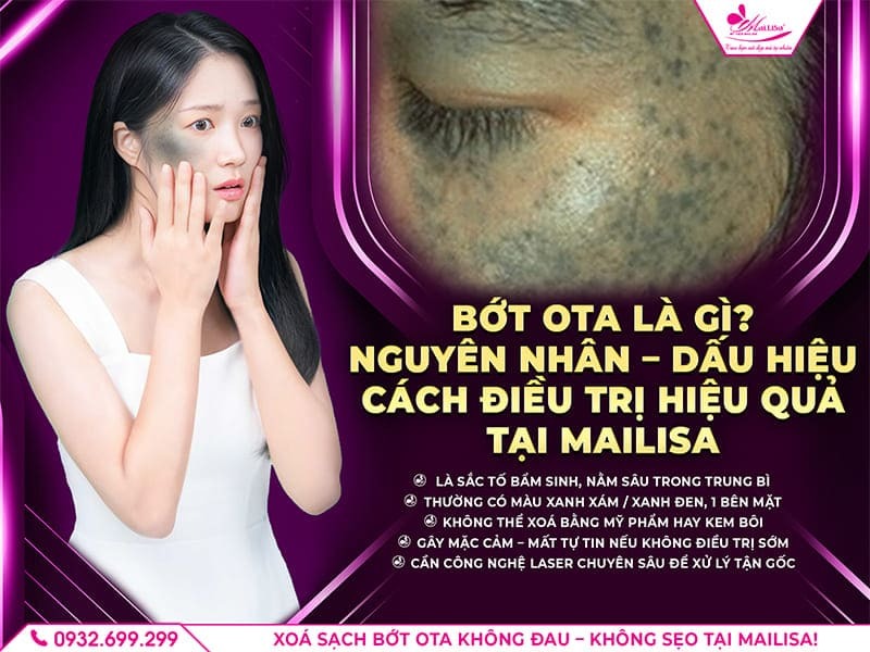 bot-ota-la-gi