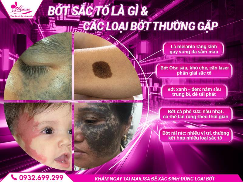 bot-sac-to-la-gi-cac-loai-bot-thuong-gap